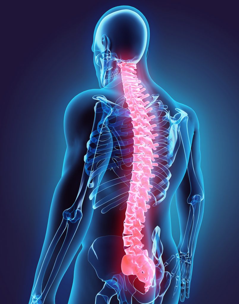 Spine Conditions and Treatments – Precision Spine Center